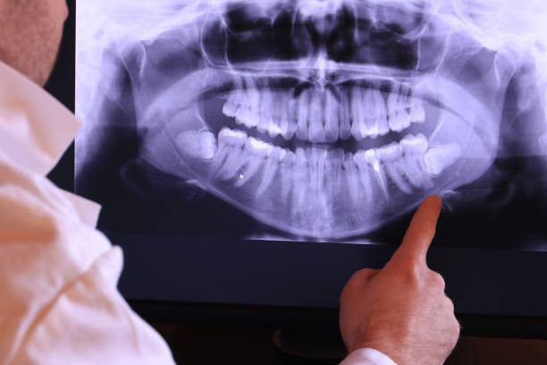 Best Dentist for Tooth Abscess  in Casper, WY